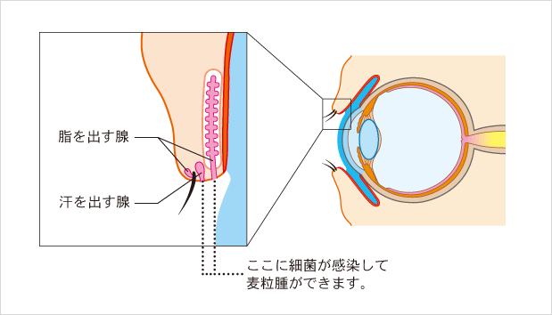 ものもらいの治療なら下赤塚駅近くの赤塚眼科はやし医院まで