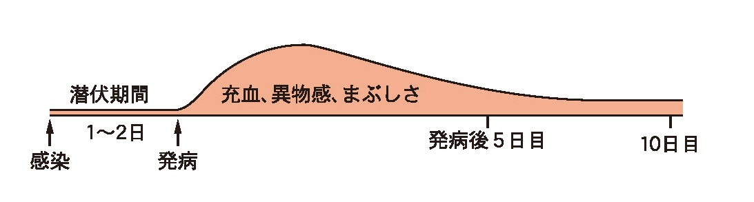 急性出血性結膜炎