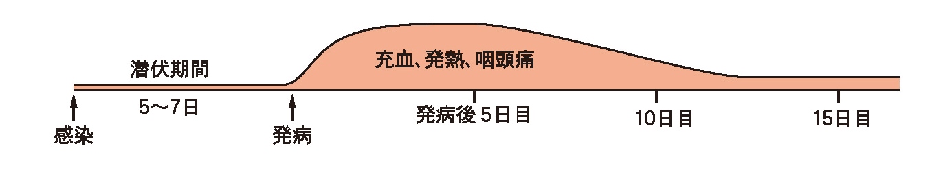 プール熱