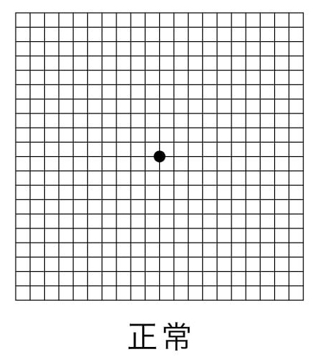正常