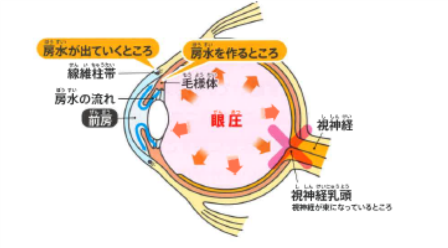 緑内障 原因